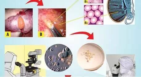 广东肇庆海军总医院供卵试管婴儿费用是多少？(2022年肇庆买卵费用参考)