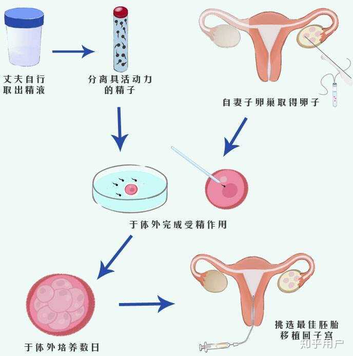 一年中哪些月份是做供卵试管婴儿的最佳时机？