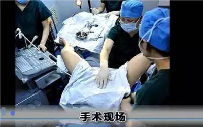 供卵试管婴儿基因检测技术能避免遗传病吗？