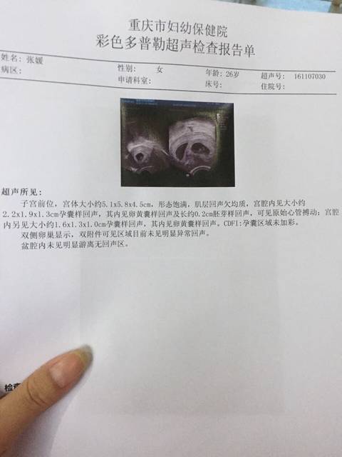 肇庆58岁的丧子母亲。赠卵试管婴儿生下龙凤胎，一人病危需紧急治疗