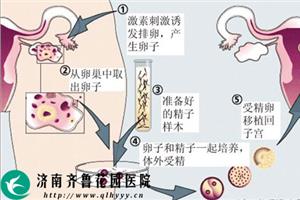 做供卵试管婴儿可以选择男性还是女性-供卵试管婴儿是男女都可以做的吗？
