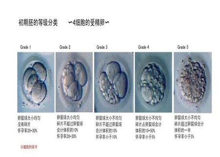 供卵试管婴儿过程的大约天数