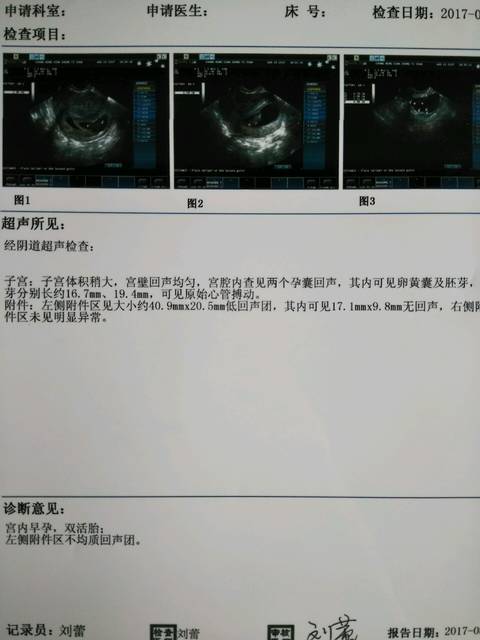 借卵公立代怀试管中容易出现空卵泡吗？