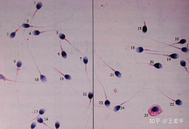 供卵生子代生试管当月不能移植-供卵试管代怀当月不能移植新鲜胚胎的原因