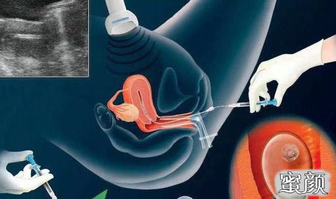PregnancyTour让您的泰国赠卵供卵代生自怀之旅更轻松