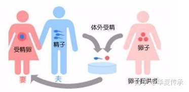 多囊卵巢备孕2年无果,在卫辉市能做借卵供卵试管吗