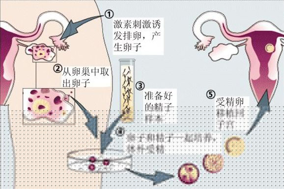 借卵做试管调内膜什么时候开始