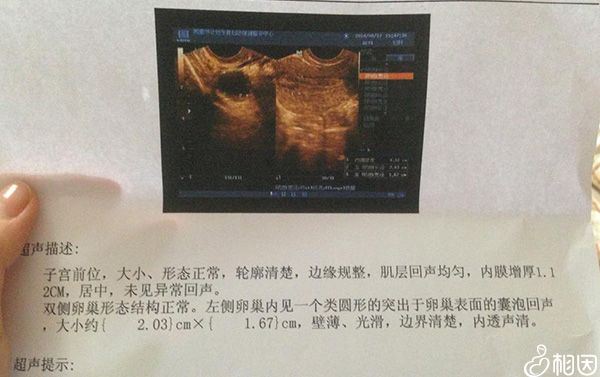 供卵试管伤身体吗女人