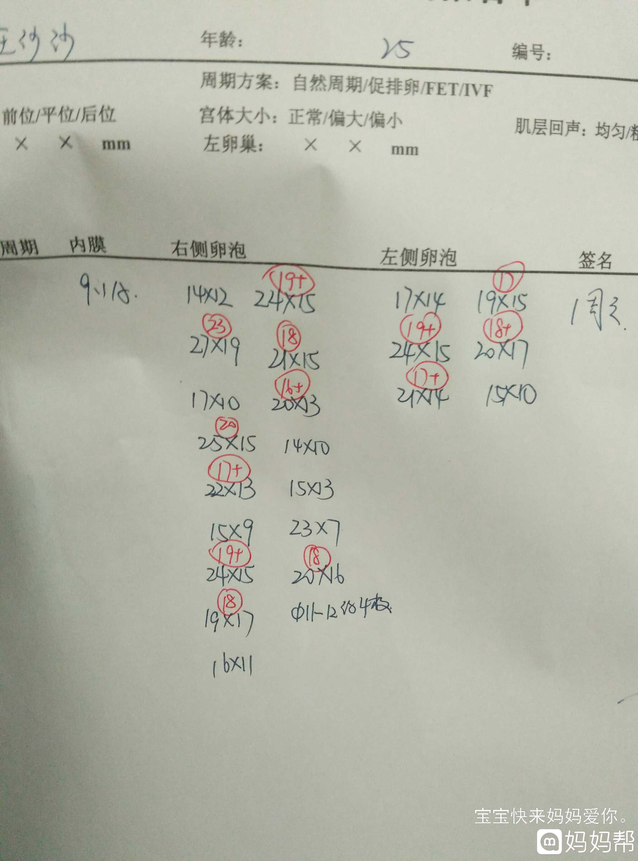 试管取卵男方提前几天排精