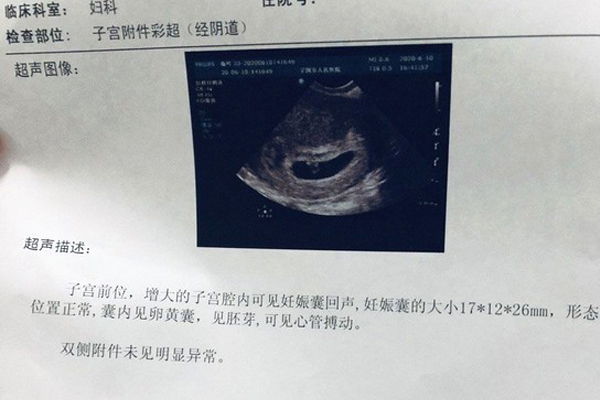 2024年生殖科医生怎么区分胚胎等级（试管费用明细一览）
